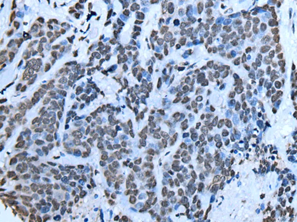 SIN3B Rabbit Polyclonal Antibody - image 1