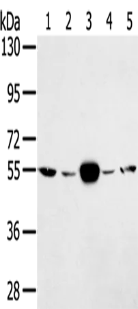 TRIM35 Rabbit Polyclonal Antibody - image 1