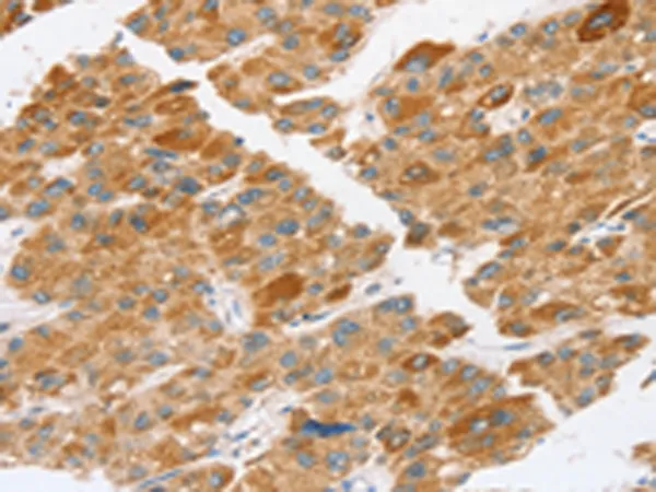 TP53I11 Rabbit Polyclonal Antibody - image 1