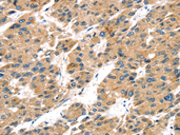 TRPV5 Rabbit Polyclonal Antibody - image 1