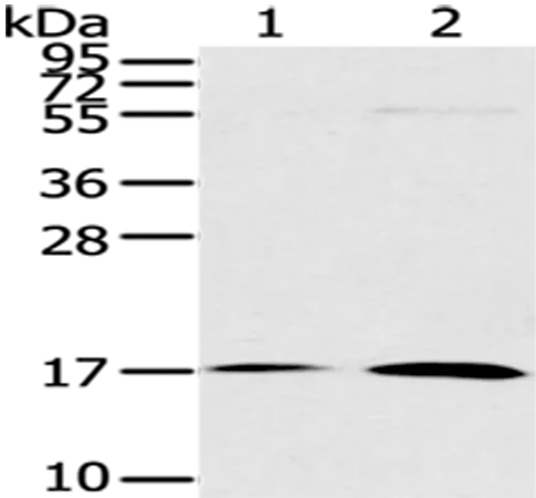 UTS2D (UTS2B) Rabbit Polyclonal Antibody - image 1