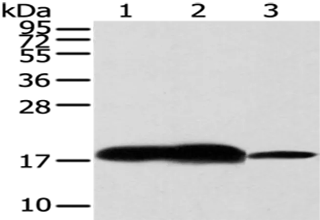 VAMP2 Rabbit Polyclonal Antibody - image 1