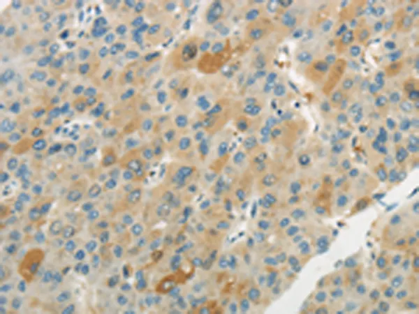 WNT2B Rabbit Polyclonal Antibody - image 1