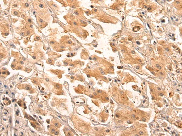 COL8A2 Rabbit Polyclonal Antibody - image 1