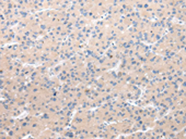 Muscarinic Acetylcholine Receptor M5 (CHRM5) Rabbit Polyclonal Antibody - image 1