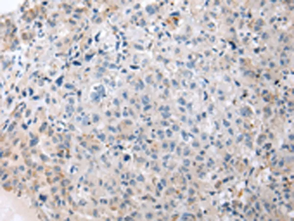 ENPP1 Rabbit Polyclonal Antibody - image 1