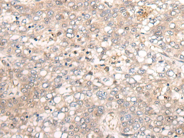 LDL Receptor (LDLR) Rabbit Polyclonal Antibody - image 1