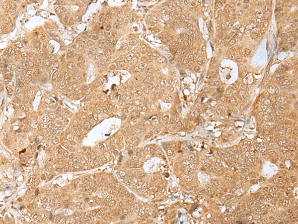 PEG3 Rabbit Polyclonal Antibody - image 1