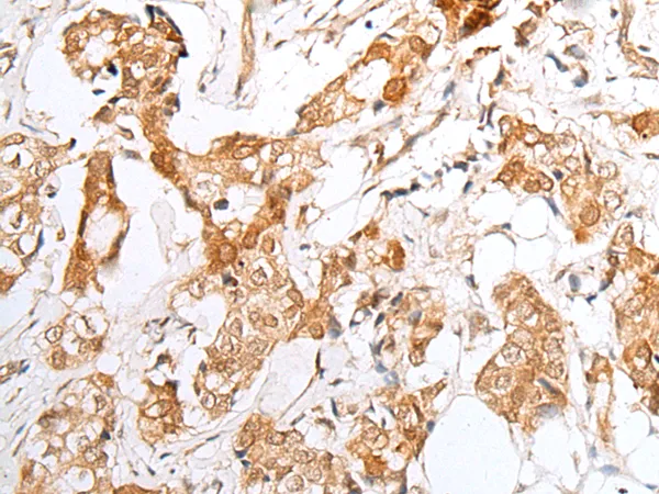 E2F3 Rabbit Polyclonal Antibody - image 1