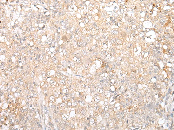 DUSP16 Rabbit Polyclonal Antibody - image 1