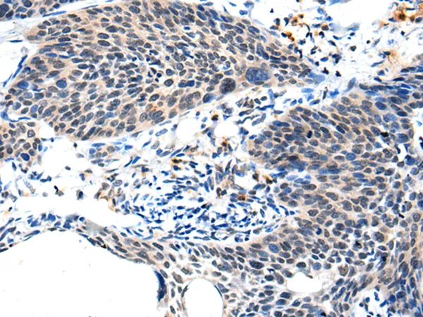 ALS2CL Rabbit Polyclonal Antibody - image 1