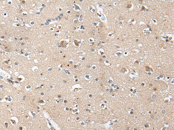 Aggrecan (ACAN) Rabbit Polyclonal Antibody - image 1