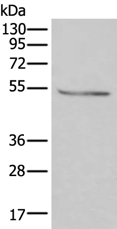 DOK2 Rabbit Polyclonal Antibody - image 1