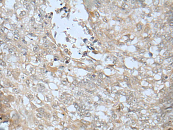LRRC23 Rabbit Polyclonal Antibody - image 1