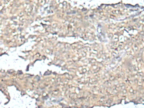 MEF2D Rabbit Polyclonal Antibody - image 1