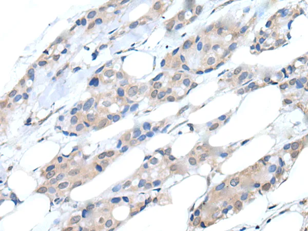 PI 3 Kinase catalytic subunit alpha (PIK3CA) Rabbit Polyclonal Antibody - image 1
