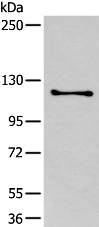 ULK1 Rabbit Polyclonal Antibody - image 1