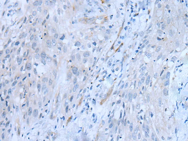 CD34 Rabbit Polyclonal Antibody - image 1