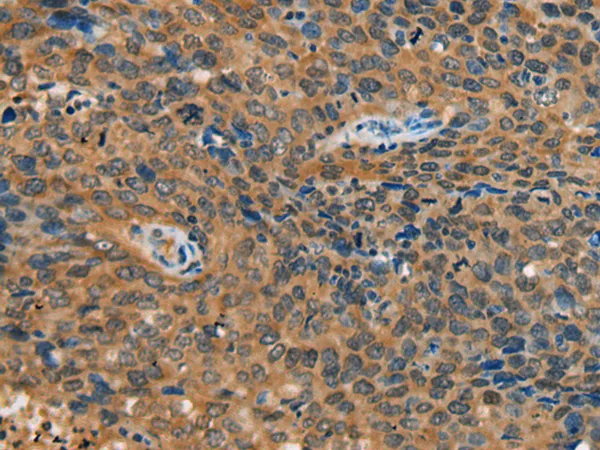 YTHDF1 Rabbit Polyclonal Antibody - image 1