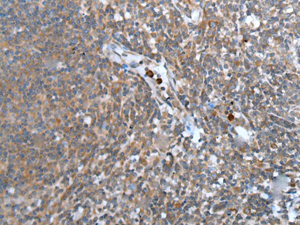 CCN5 Rabbit Polyclonal Antibody - image 1
