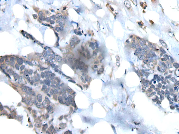 VPREB1 Rabbit Polyclonal Antibody - image 1
