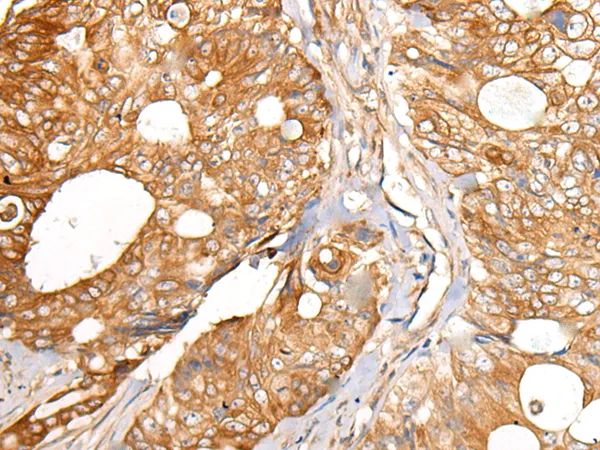 Carboxypeptidase D (CPD) Rabbit Polyclonal Antibody - image 1