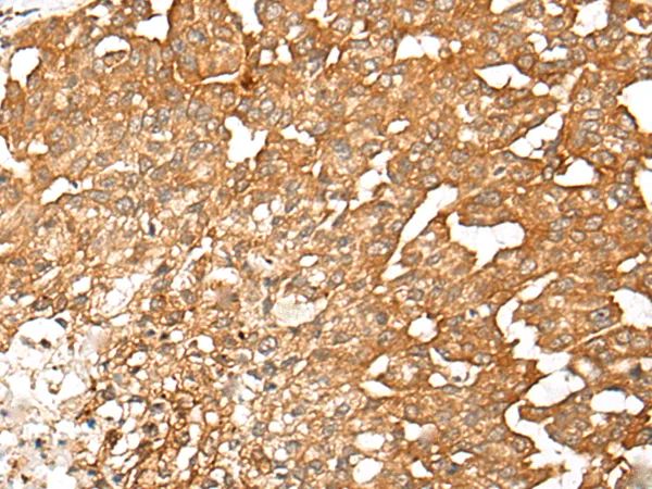 CAT1 (SLC7A1) Rabbit Polyclonal Antibody - image 1