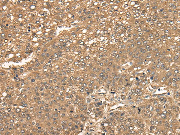 CCNYL1 Rabbit Polyclonal Antibody - image 1