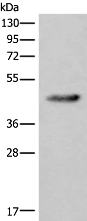 CDKL4 Rabbit Polyclonal Antibody - image 1