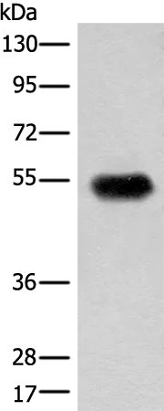 CDT1 Rabbit Polyclonal Antibody - image 1