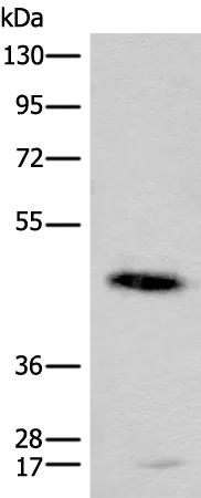 Cell adhesion molecule 2 (CADM2) Rabbit Polyclonal Antibody - image 1