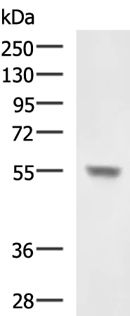 CHST3 Rabbit Polyclonal Antibody - image 1