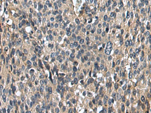 UNC5B Rabbit Polyclonal Antibody - image 1