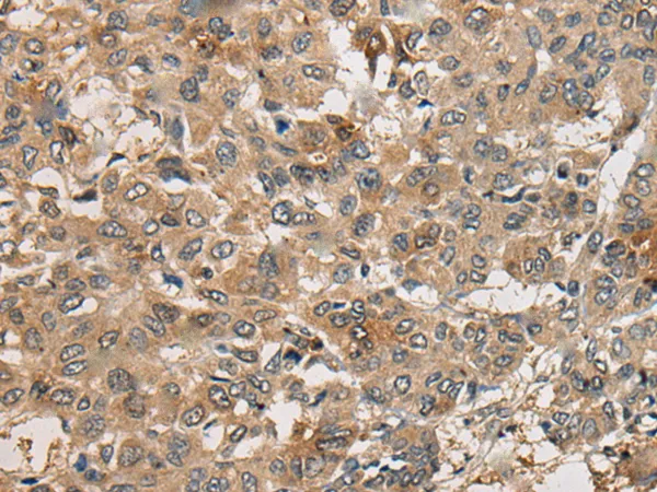 Coatomer subunit delta (ARCN1) Rabbit Polyclonal Antibody - image 1