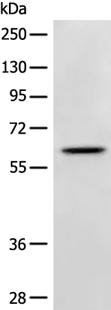 Netrin G2 (NTNG2) Rabbit Polyclonal Antibody - image 1