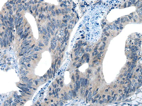 PIWIL2 Rabbit Polyclonal Antibody - image 1