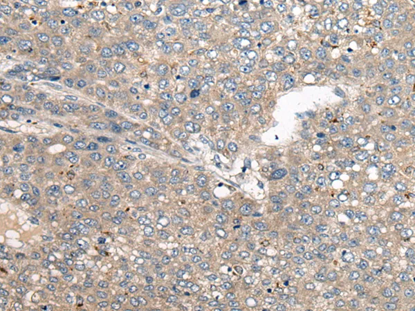 NRG2 Rabbit Polyclonal Antibody - image 1