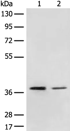 MBD2 Rabbit Polyclonal Antibody - image 1