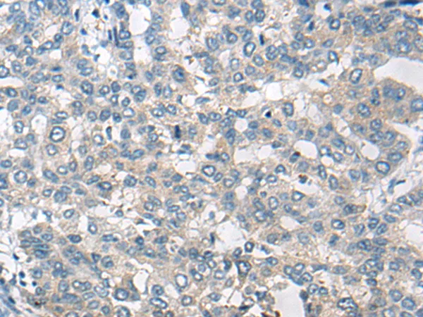 Nav1.5 (SCN5A) Rabbit Polyclonal Antibody - image 1