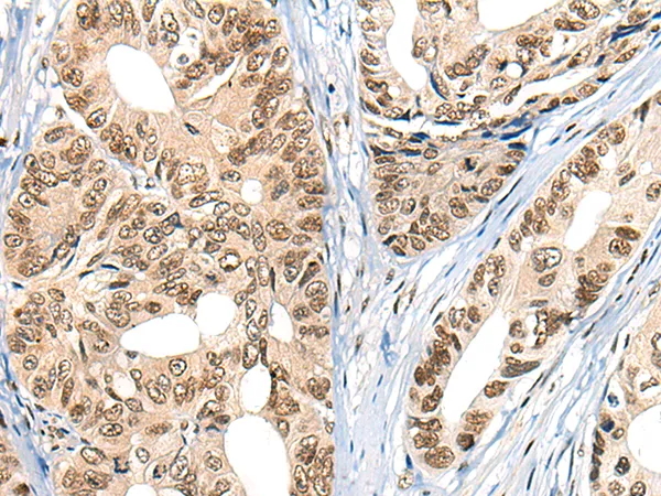 Mortality Factor 4 like 2 (MORF4L2) Rabbit Polyclonal Antibody - image 1