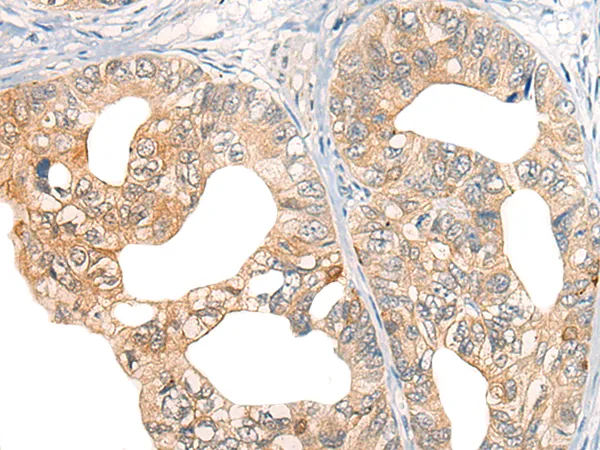 CORO2A Rabbit Polyclonal Antibody - image 1