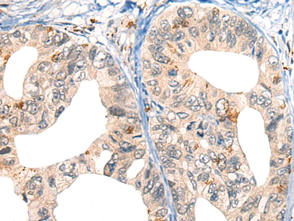 CORO2B Rabbit Polyclonal Antibody - image 1