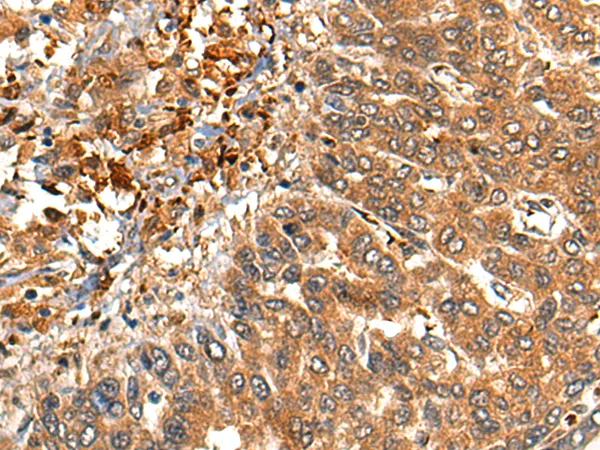 MARK3 Rabbit Polyclonal Antibody - image 1
