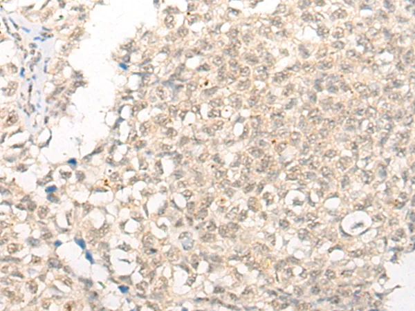 CPSF2 Rabbit Polyclonal Antibody - image 1