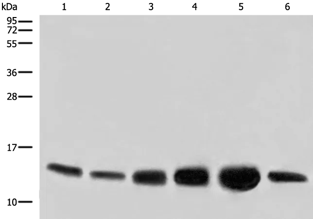 Cytochrome C Oxidase subunit VIc (COX6C) Rabbit Polyclonal Antibody - image 1