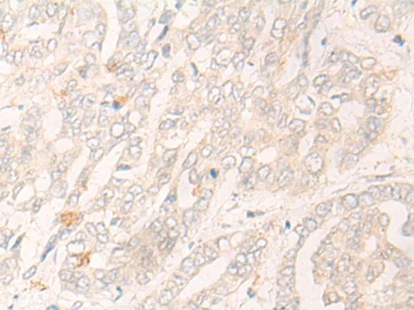 Cytochrome p450 2C19 (CYP2C19) Rabbit Polyclonal Antibody - image 1