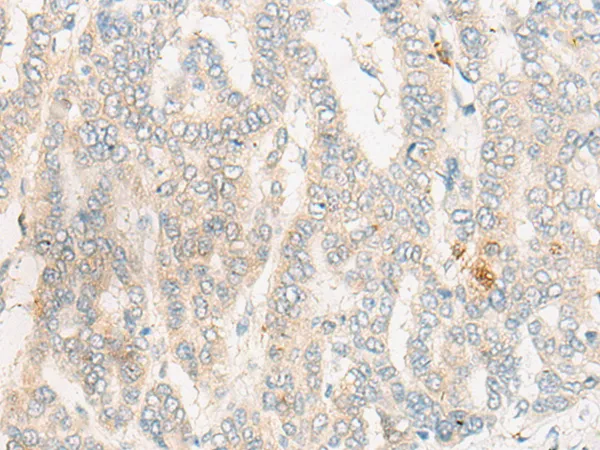 DCAF17 Rabbit Polyclonal Antibody - image 1