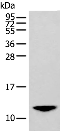 BAGE2 Rabbit Polyclonal Antibody - image 1