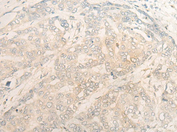 DZIP1 Rabbit Polyclonal Antibody - image 1