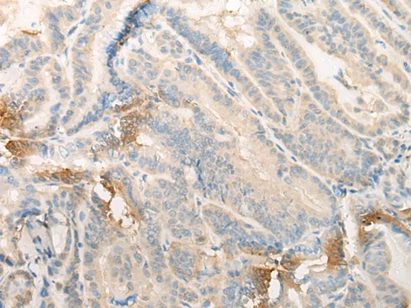 EFCAB5 Rabbit Polyclonal Antibody - image 1